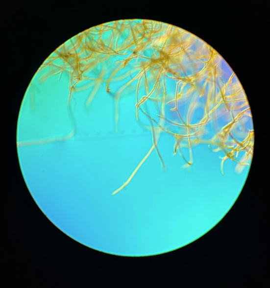 images of microalgae throough a microscope